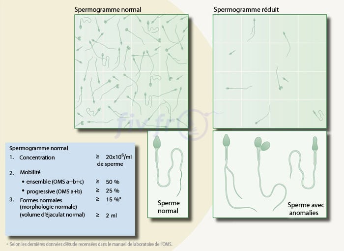2-qualite-du-sperme