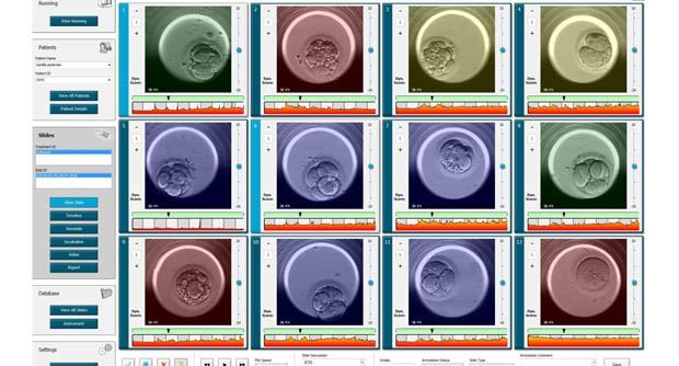 embryoscope 3