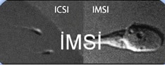 icsi_imsi1