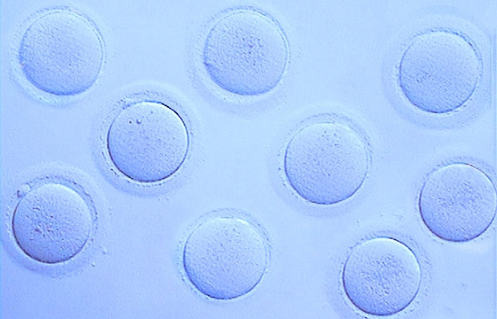 Aspect des ovocytes avant d’être vitrifiés