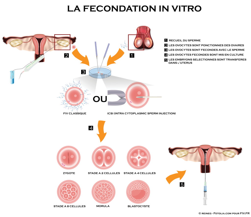 schema fecondation in vitro2