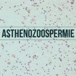 Asthénozoospermie (asthénospermie)