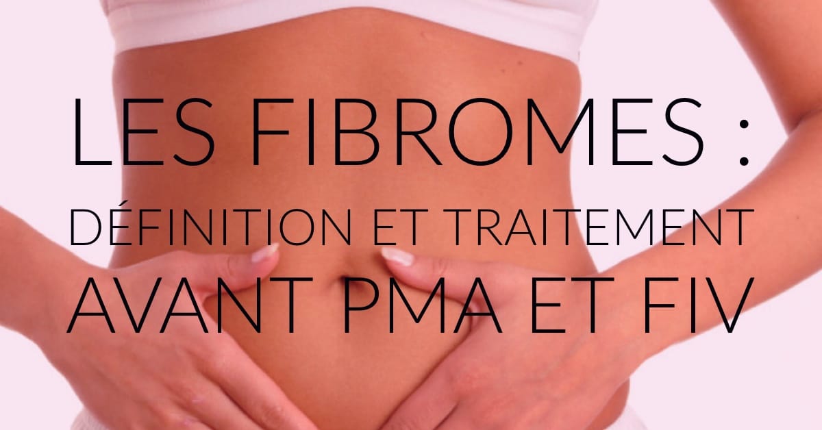 Les fibromes : définition et traitement avant PMA et FIV • Fiv.fr