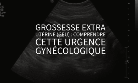 Grossesse extra utérine (GEU) : comprendre cette urgence gynécologique
