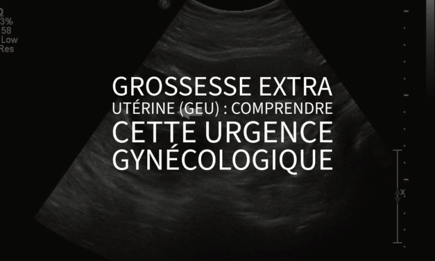 Grossesse extra utérine (GEU) : comprendre cette urgence gynécologique