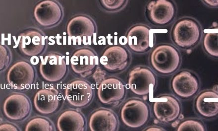 Hyperstimulation ovarienne : quels sont les risques et peut-on la prévenir ?