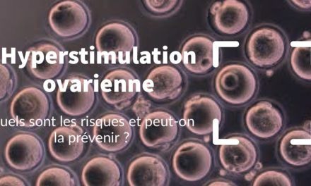 Hyperstimulation ovarienne : quels sont les risques et peut-on la prévenir ?