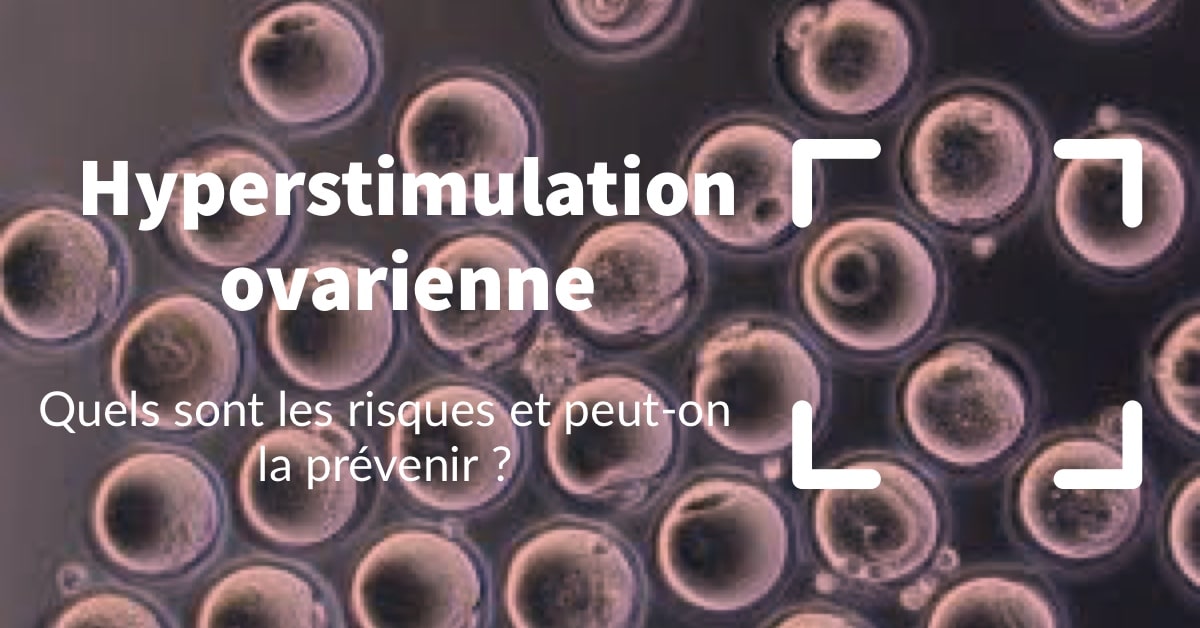 Hyperstimulation ovarienne quels sont les risques et peuton la