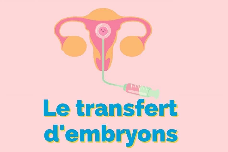 Le transfert d'embryons